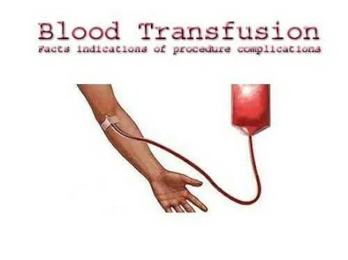 Blood Transfusion Facts